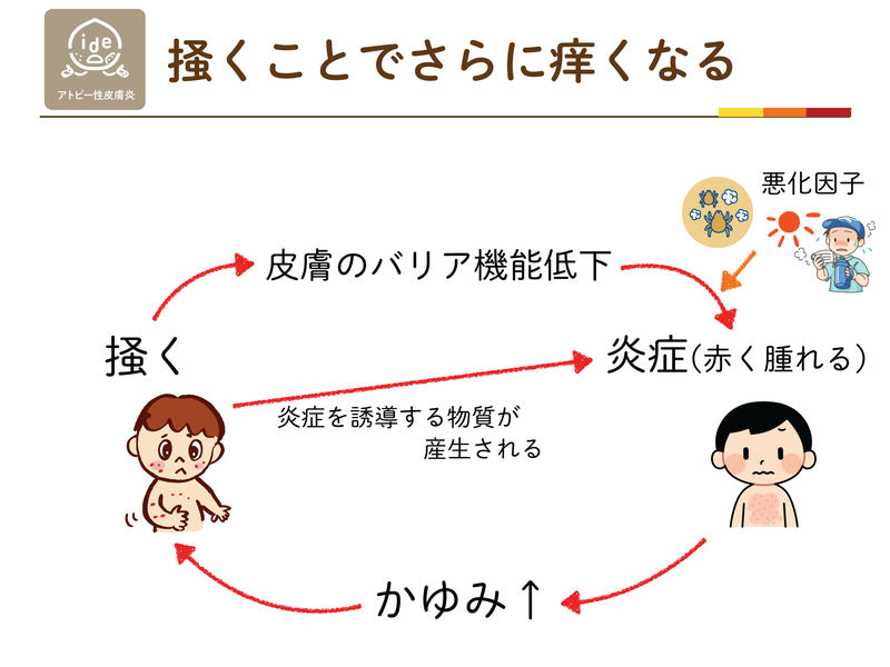 掻くことでさらに痒くなる悪循環。掻く、皮膚のバリア機能低下、炎症、かゆみの増強が繰り返される
