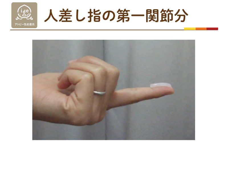 人差し指の第一関節分（1FTU）の軟膏量
