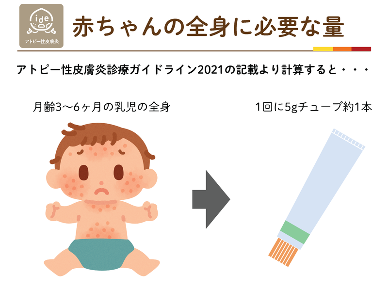 月齢3〜6ヶ月の乳児の全身には1回に5gチューブ約1本分の軟膏が必要