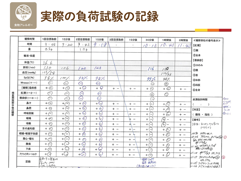 食物経口負荷試験の実際の記録用紙。摂取量と時刻ごとに症状を記録している
