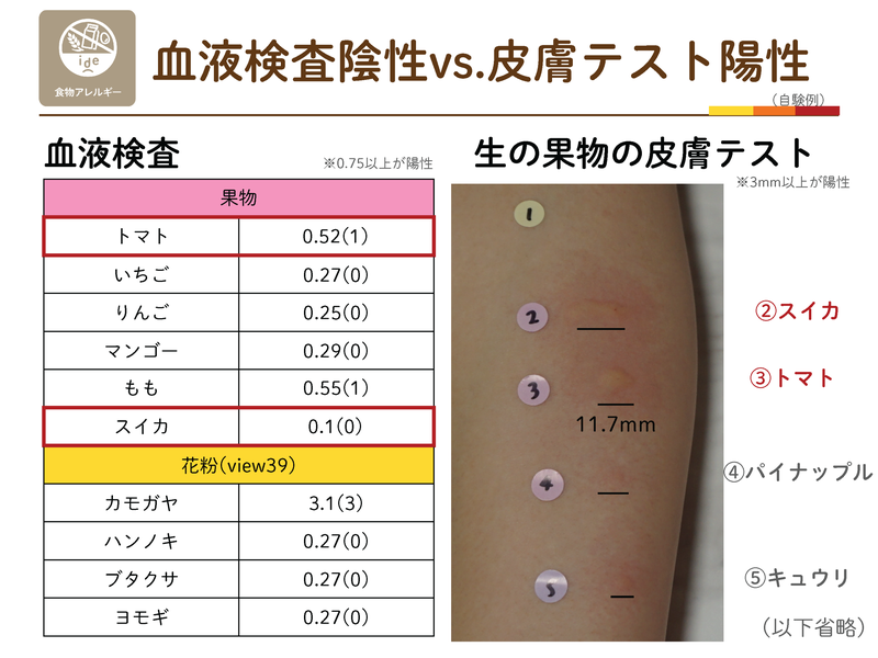 血液検査は陰性でも皮膚テストで強陽性となった当院の例。トマト・スイカの検査値と生の果物の皮膚テスト写真