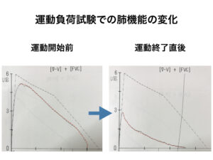 喘息の運動負荷試験を始めました！